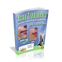 Tratamentos Acne!