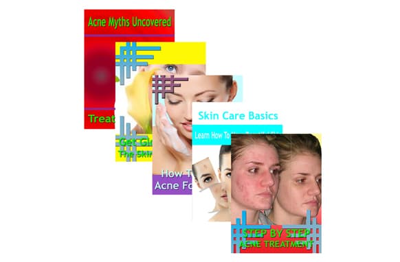 Coleção Beating Acne 5 Guias