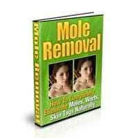 Remoção de Mole
