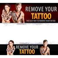Modelo de remoção de tatuagem