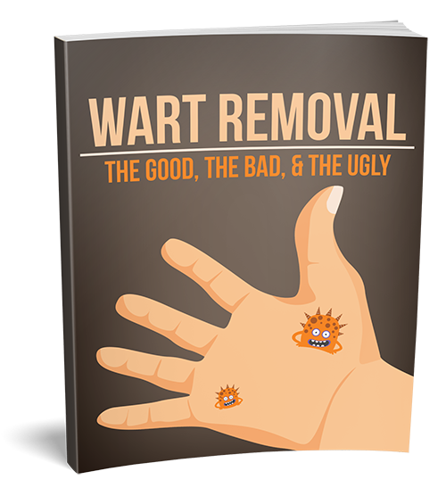 Wart Removal